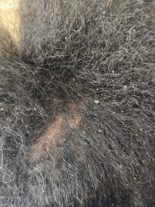 Démangeaisons Cuir Chevelu Cheveux Crépus : 7 Solutions Naturelles Qui Marchent