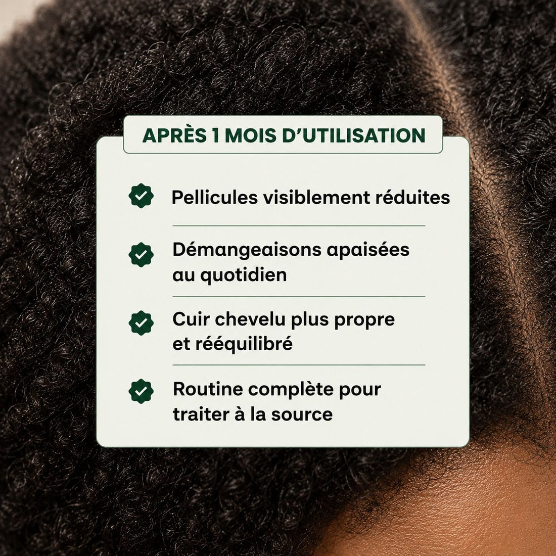 💙 Pack Traitement Complet CURASCALP – Adieu Pellicules & Démangeaisons
