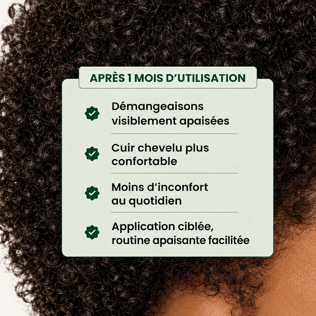 💧 Huile Apaisante & Purifiante – Soin Ciblé | CURASCALP