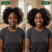💧 Huile Apaisante & Purifiante – Soin Ciblé | CURASCALP