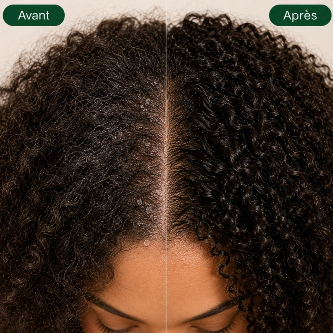✈️ Kit Voyage & Découverte –  Duo Détoxiques curascalp (2 x 100 ml)